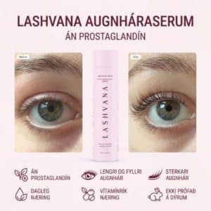 Lash Growth Serum fyrir og eftir